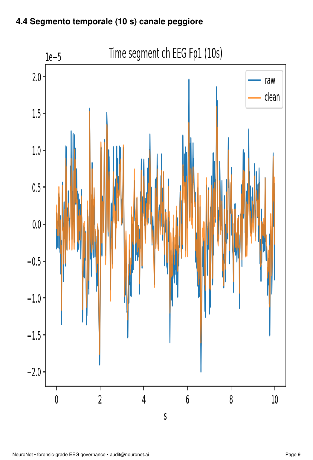 Per-channel EEG cleaning view